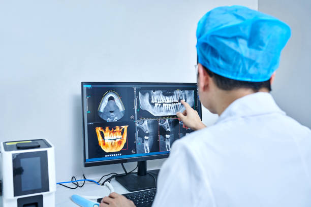 Best Emergency Tooth Extraction in Monrovia, CA